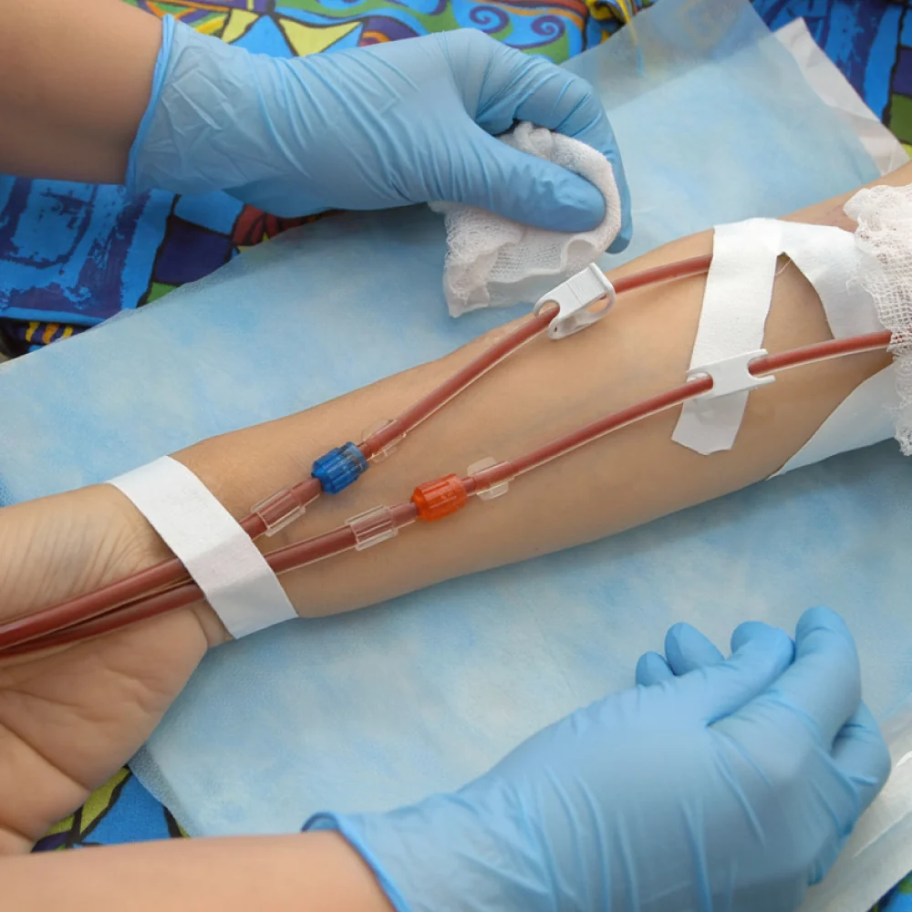 Curso de Accesos Vasculares Para Hemodiálisis: Ecografía, CVC Tunelizado, Manejo de Fístulas e Injertos