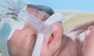 Curso de Atención al Neonato con Dificultad Respiratoria y con Fase Ventilatoria Instalación de CPAP