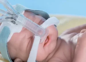 Curso en Salud de Enfermería Especializada en CPAP Nasal Neonatal: Uso, Mantenimiento y Prevención de Complicaciones