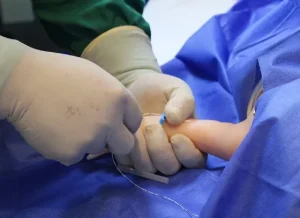 Curso en Salud de Catéter PICC Neonatal Actualizaciones Sobre Técnica de Inserción