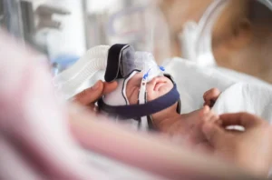 Excelencia en Cuidados Neonatales, Avances y Estrategias con CPAP Nasal