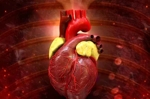 Curso en Salud de Intervenciones de Enfermería en Patologías Cardiovasculares en las Distintas Áreas de Atención