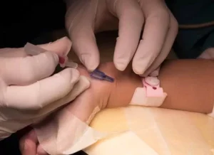 Curso en Salud de Manejo del Análisis de Gases Arteriales (AGA) en el Paciente Pediátrico Crítico