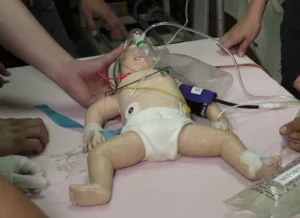 Curso en Salud de Manejo del Paciente Pediátrico en Sepsis