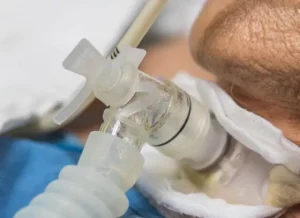 Curso en Salud de Ventilación Mecánica Invasiva y No Invasiva Prácticas Profesionales y Seguridad del Paciente